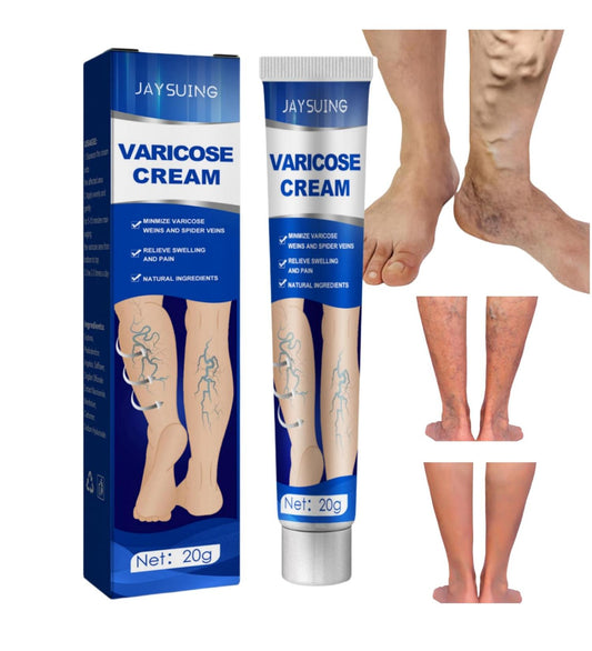Tratamiento de Venas Varices & Dolor De Piernas