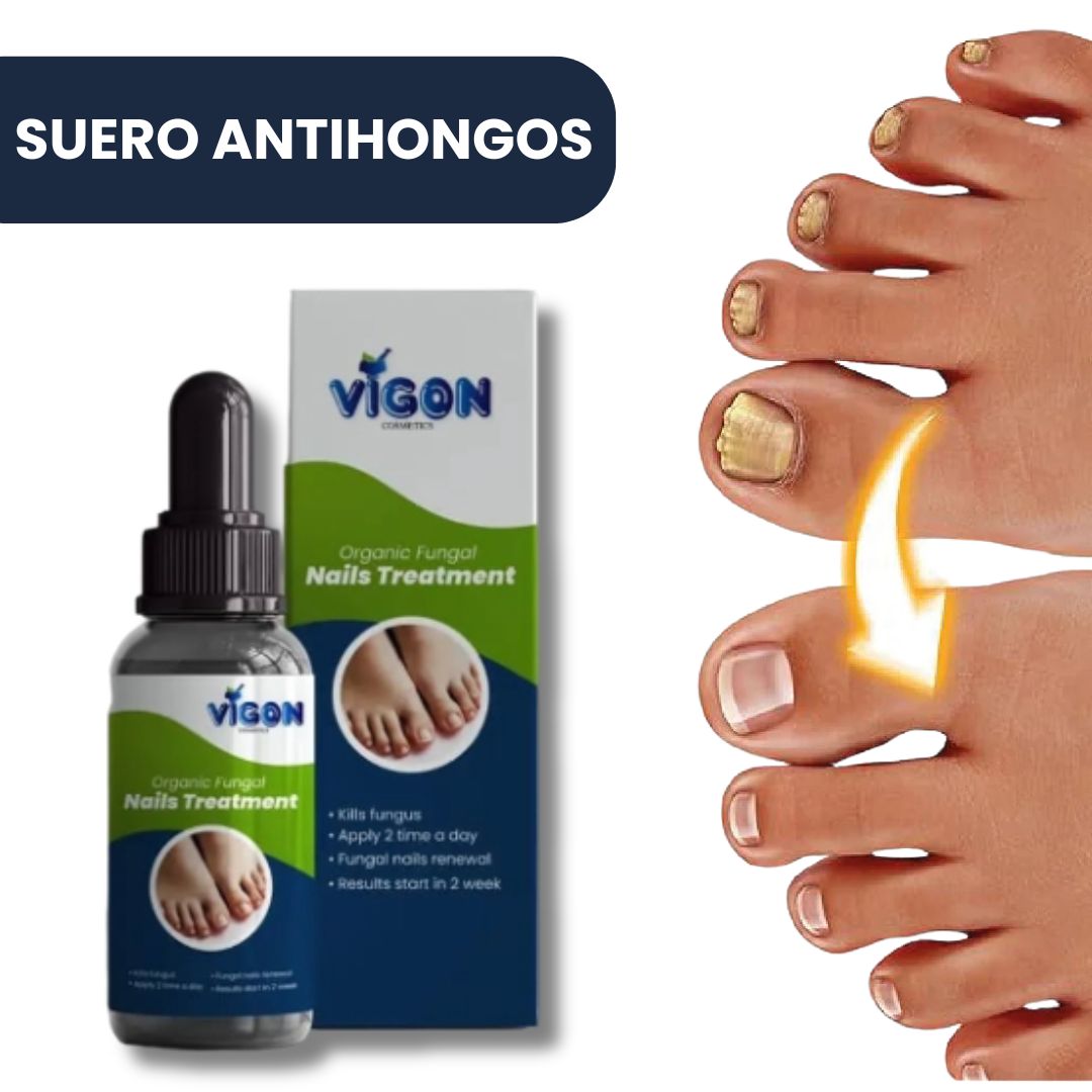Suero Reparador de uñas Antihongos